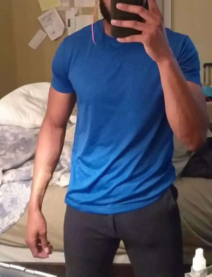 Took a lot of nerve to wear these shorts posted by VisStimRush