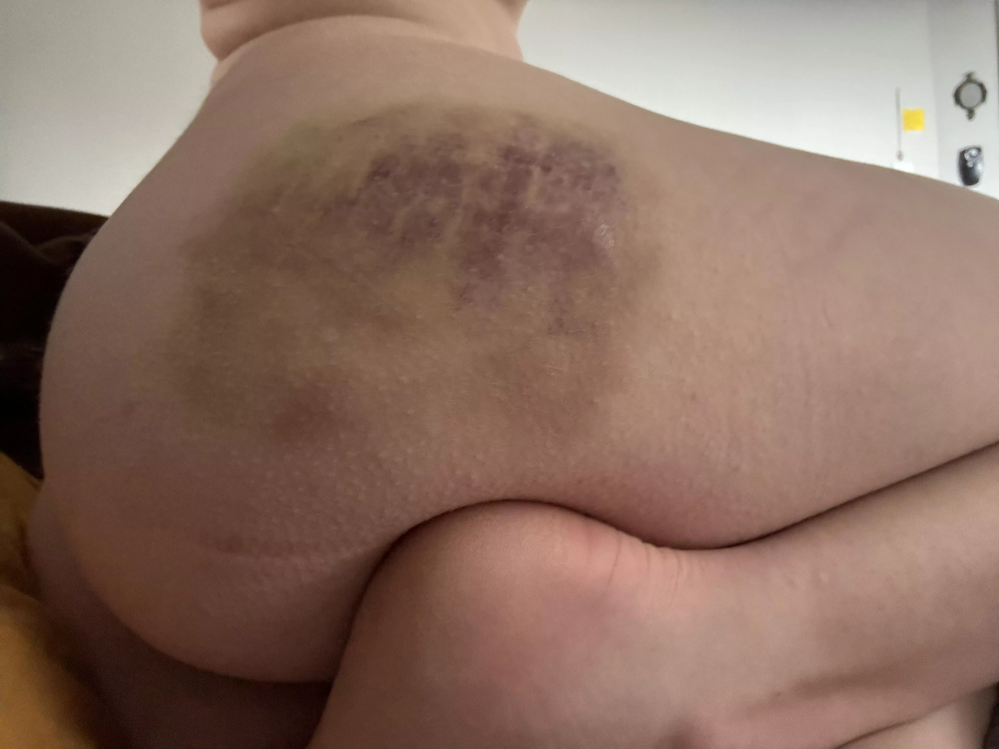 Results of being a bit too bratty :( posted by Soulless-Soles