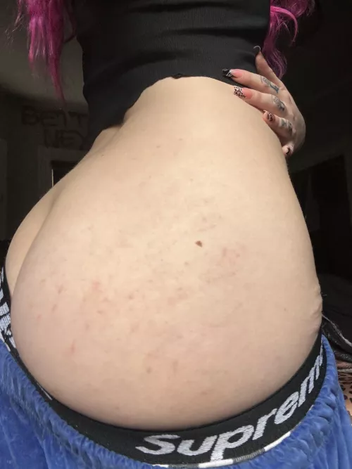 light bruising from getting spanked,,, i deserve more💗 by laceratedlady