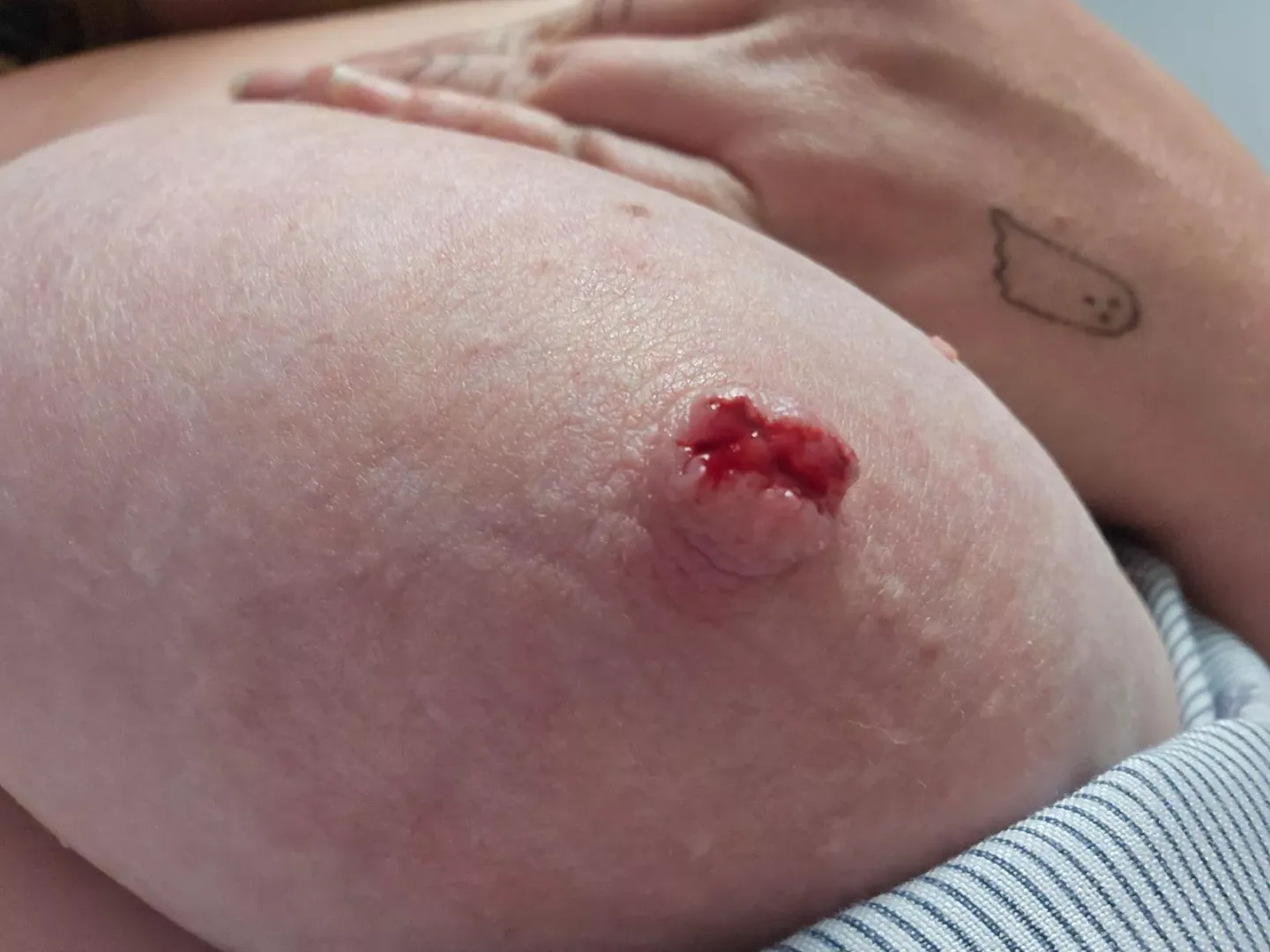 My piercing got caught today and completely ripped out of my nipple 🥲 by shyshy7171