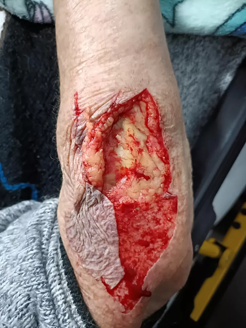 Old people skin is the worst  posted by ShedPooCrypto