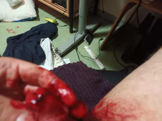 Penis live operation by BreadFine