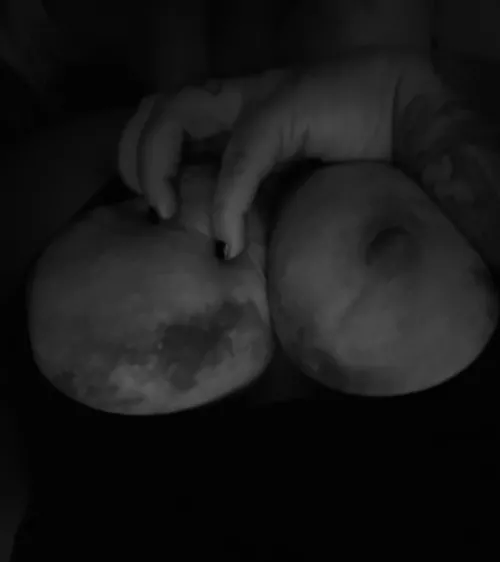 Bruised breasts look like the moon 😻 by eat_the_peach