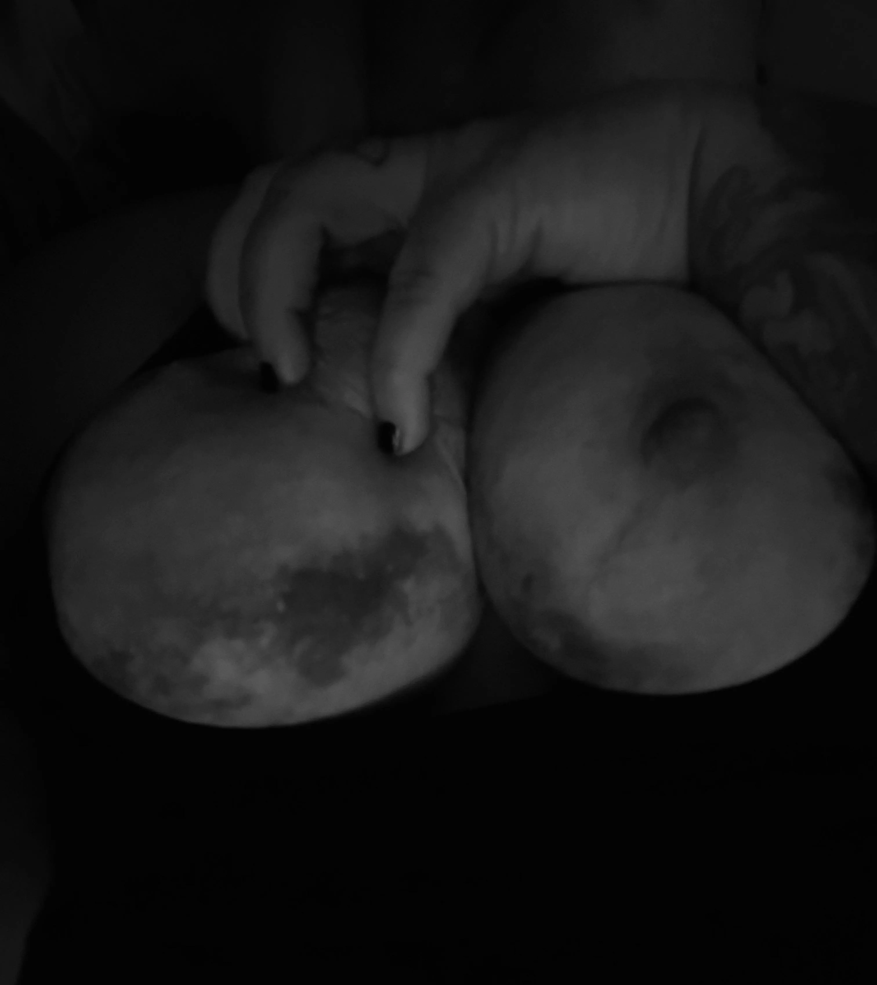 Bruised breasts look like the moon 😻 posted by eat_the_peach