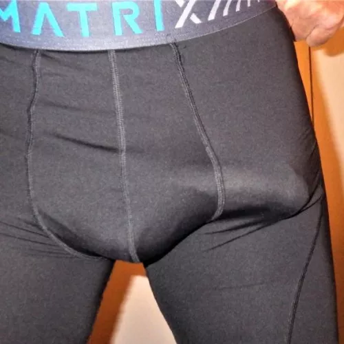 Good support. by your-x-ray