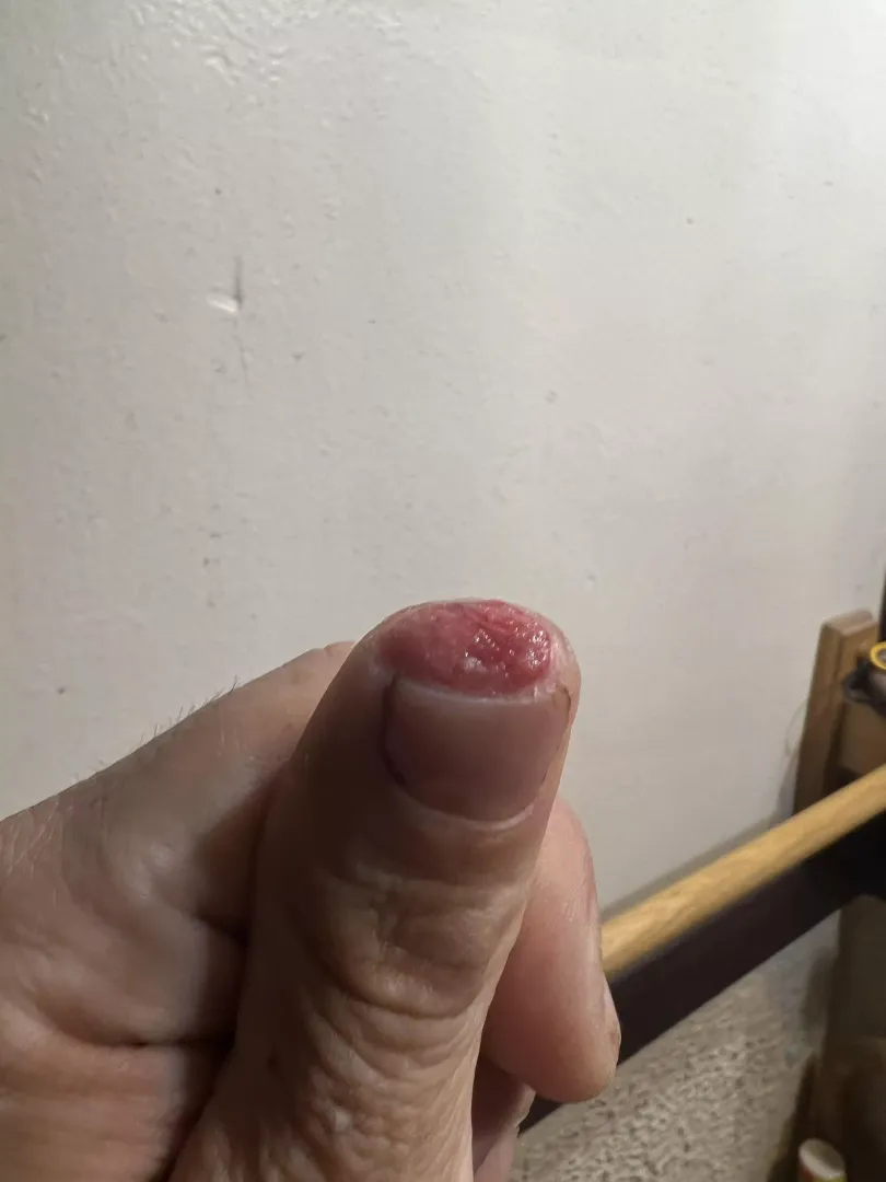 Chopped the tip of my thumb off by Spmex7