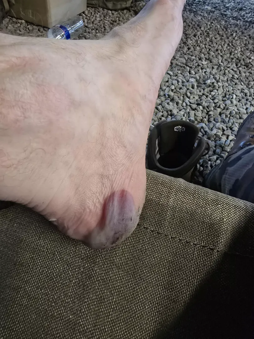 Don't change your boots before a long ruck posted by ASecondGo