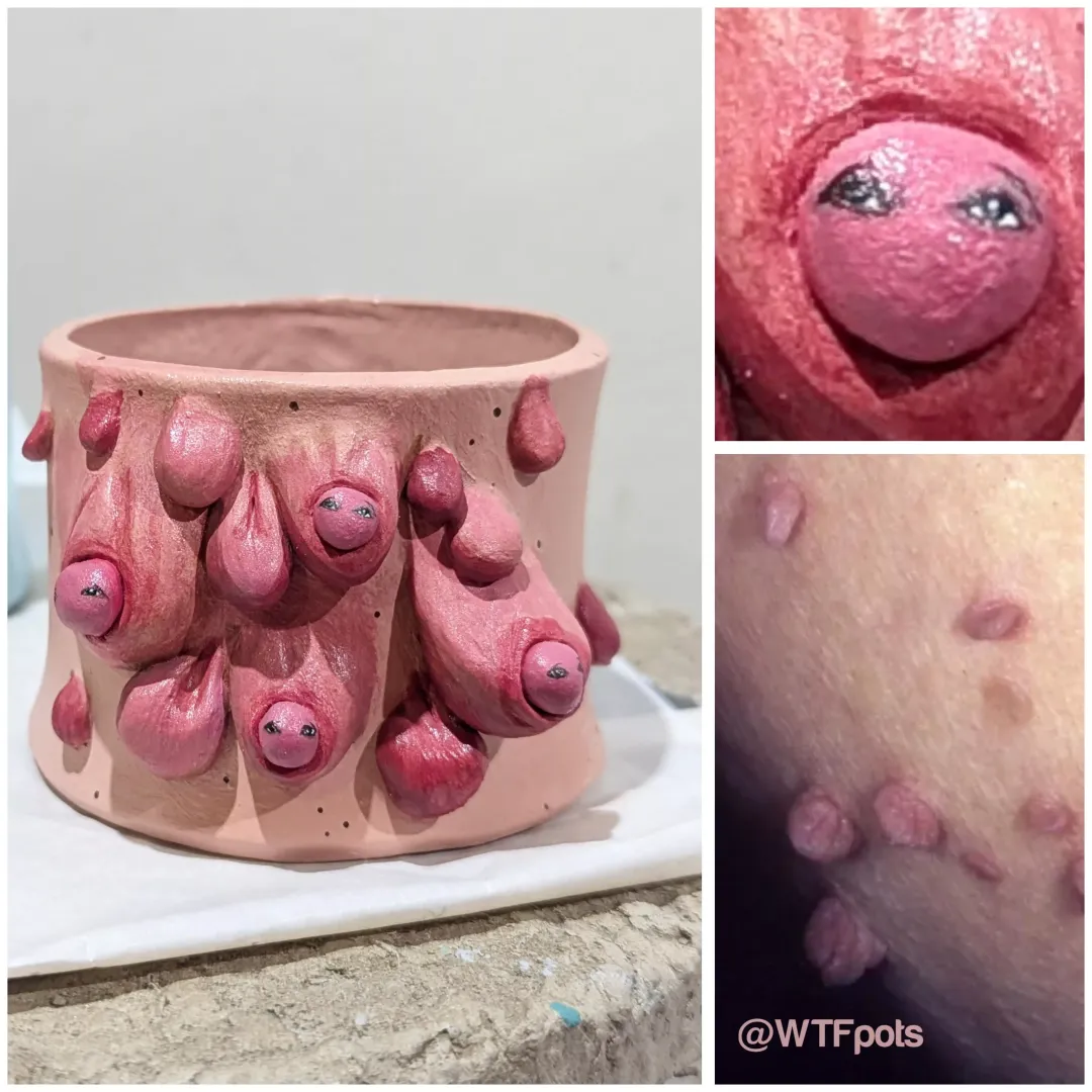 [self] Today I'm celebrating because after 2 long years my skin tag pot is finally going to her forever home 🥹. Made with air dry clay by OtherwisePop6430