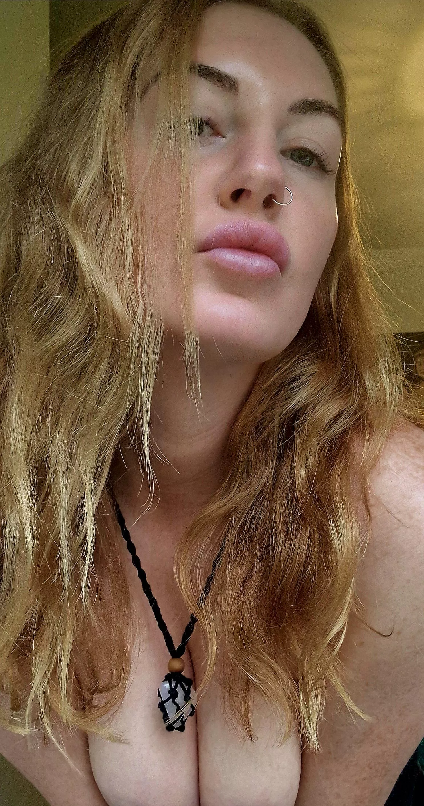  The sun has dissappeared but my freckles are here to stay [IRTR] posted by clarrisacrystal