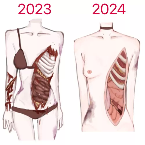 Re draw of a old guro drawing i did a year ago:3 by Minute-Date-time