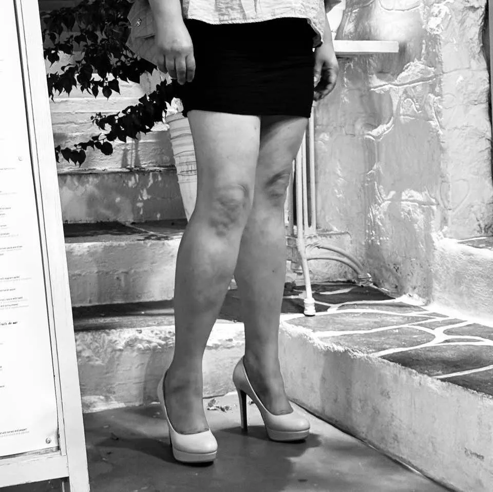 People say that my lady have gorgeous legs. What do you think? 😌🦵👠 posted by Least_Software1779