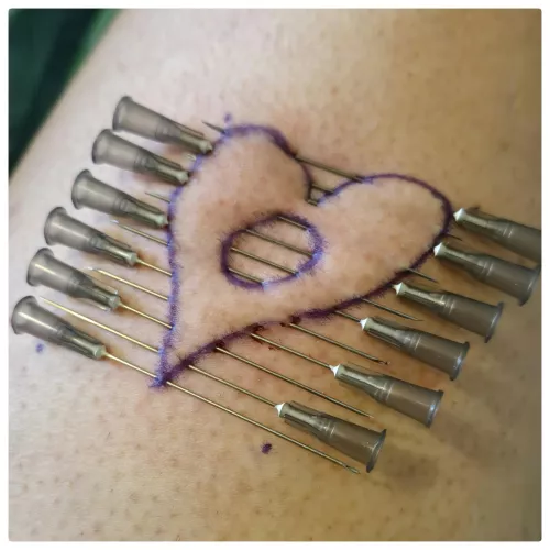 When you need(le) some love by WonderLizzy_