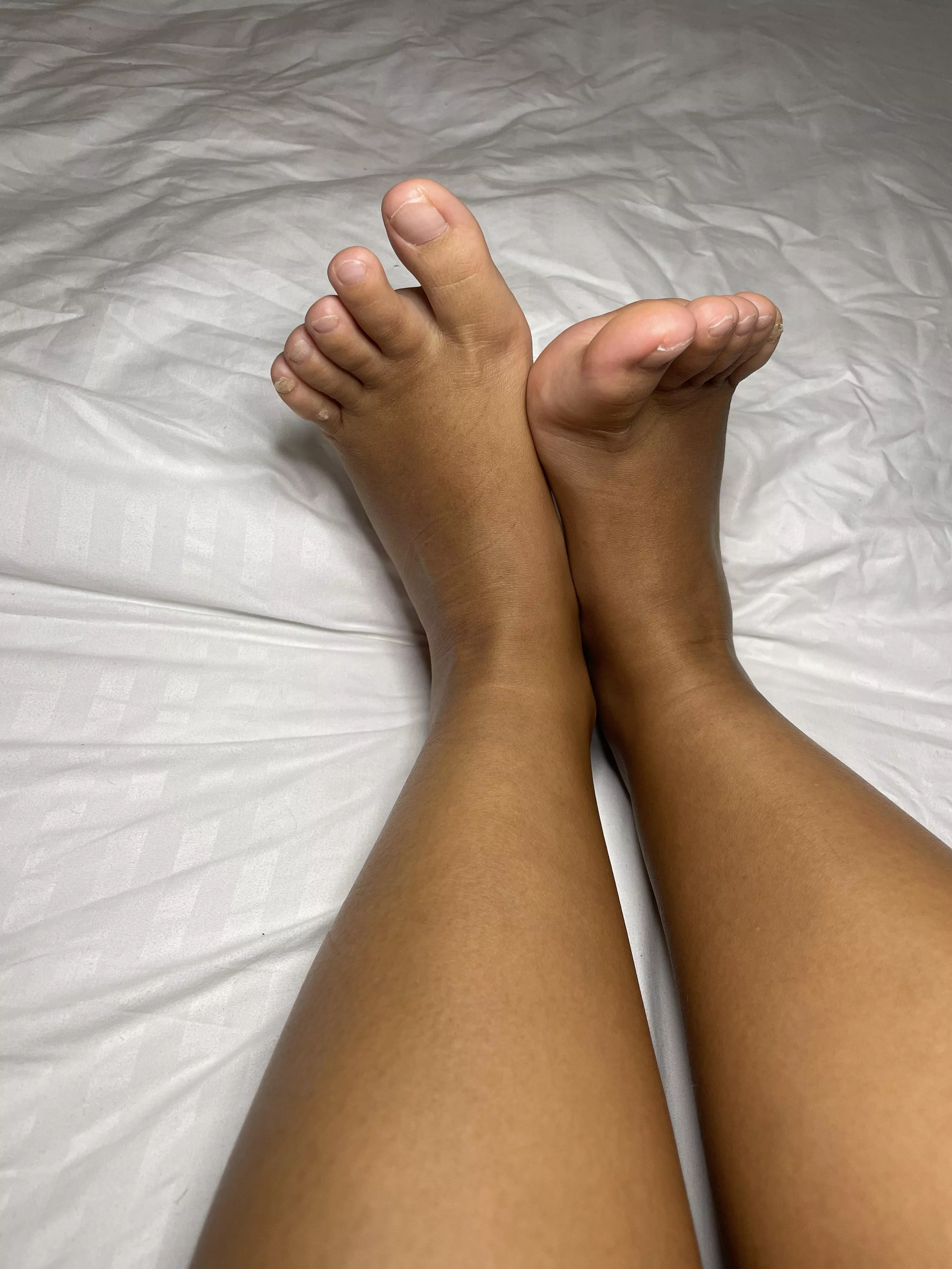 Hope you like my thick toes posted by ApprehensiveTopic925