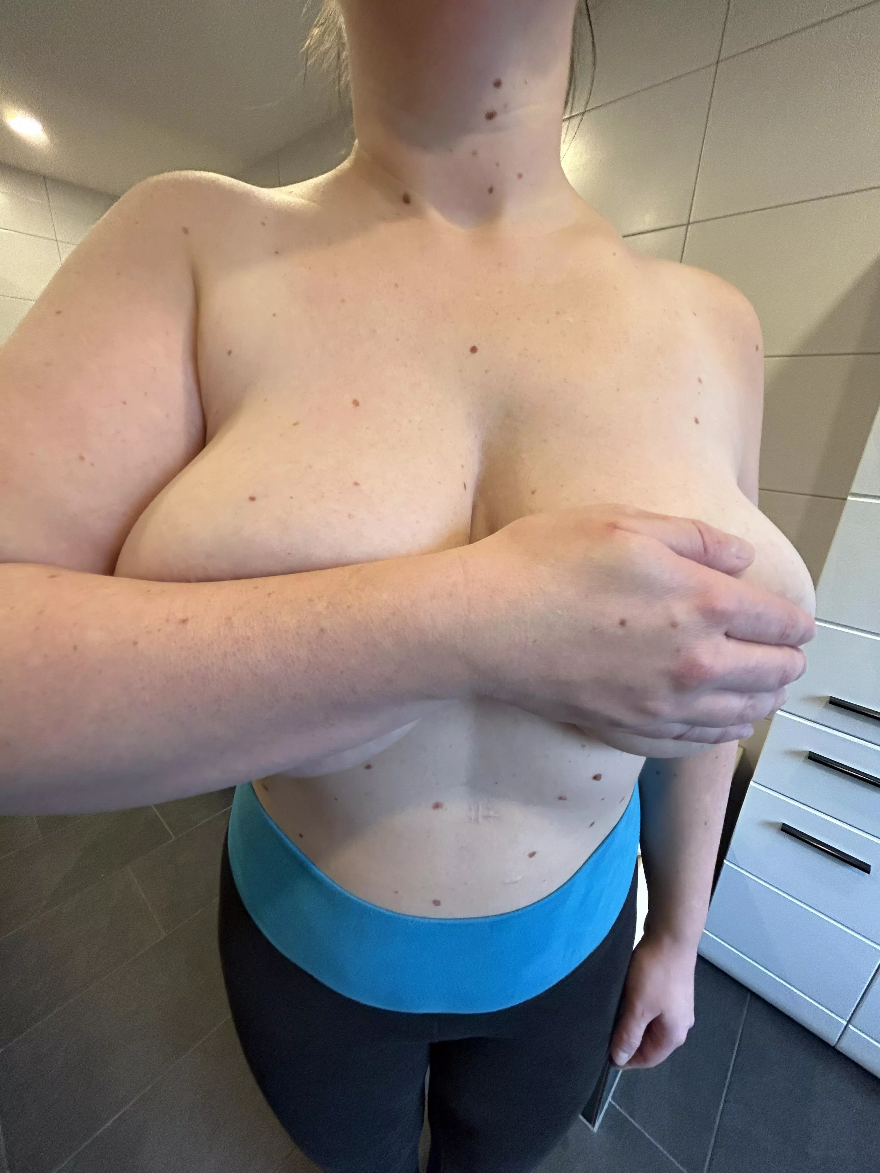 Hopefully they stopped growing now posted by Current_Swing_75