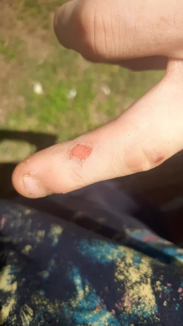 My finger was itchy last night by BrostroGaming
