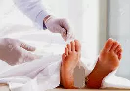 After you die, when they take you to the morgue. Do the Dr.s rest your dick ever-so-gently on your nuts? Or do they let your cock lean where gravity decides?? posted by YaBoiZorg