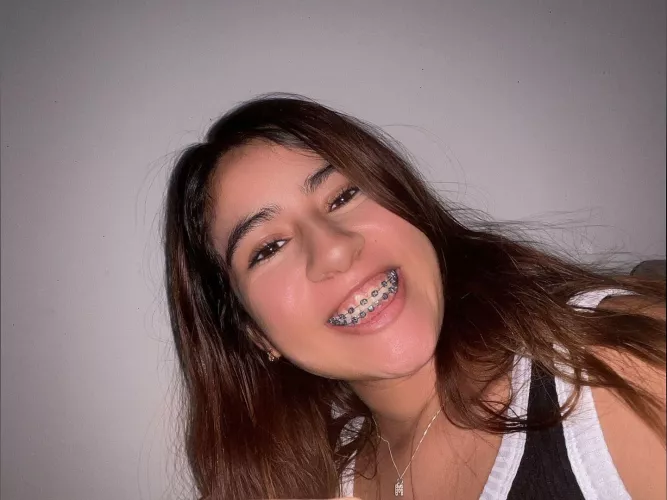 My slutty braces need more cum! Please help! by wab_polla2