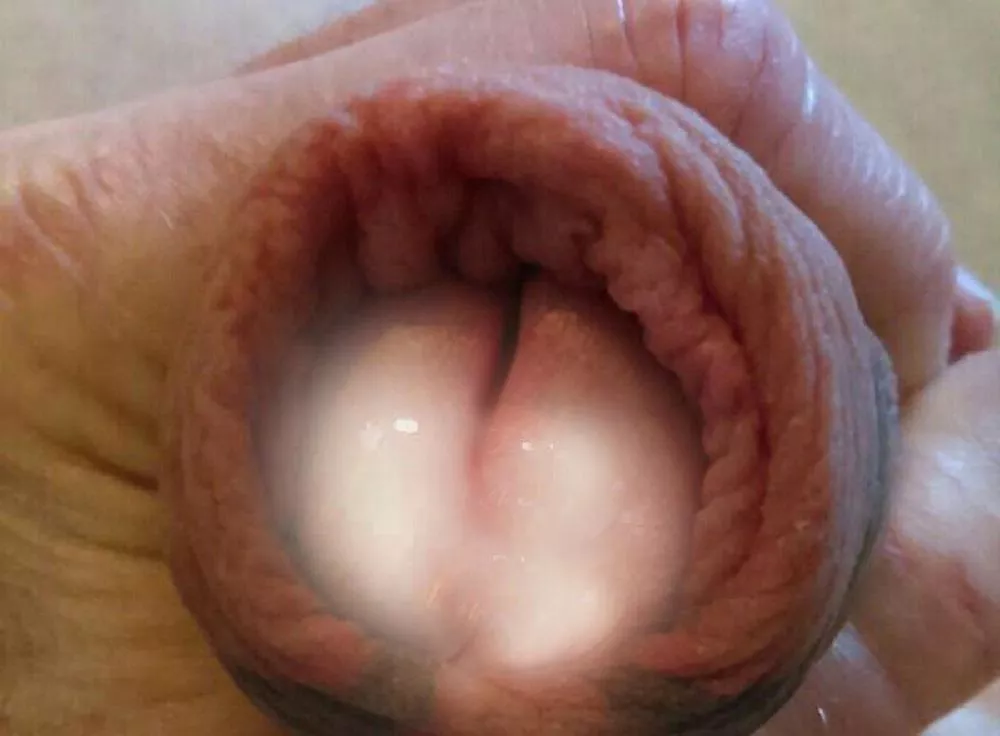 Meato Cum posted by Restoredude