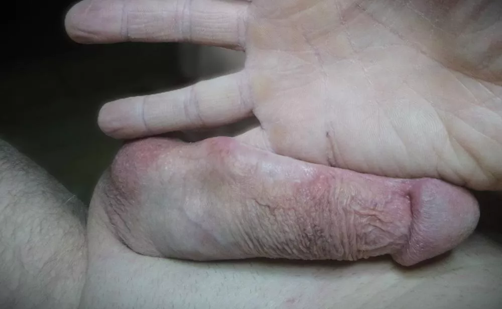 auricular sounding posted by cassoulem