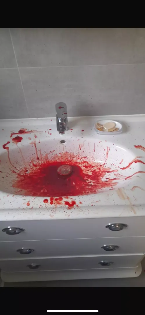 Had a nose bleed :) by Paige-Forster
