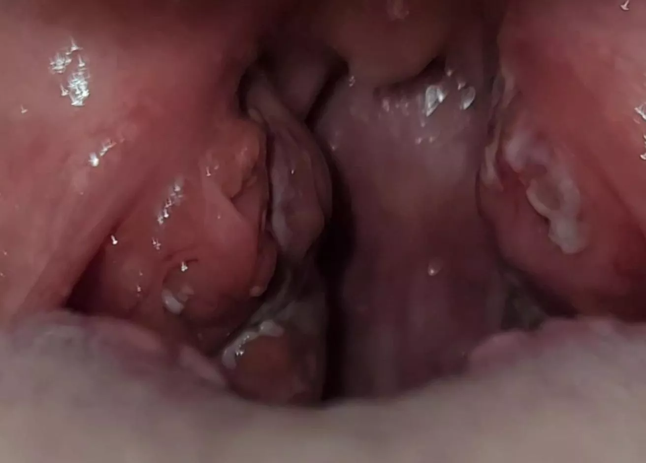 My balls hurt, my mouth balls posted by SanaOnReddit