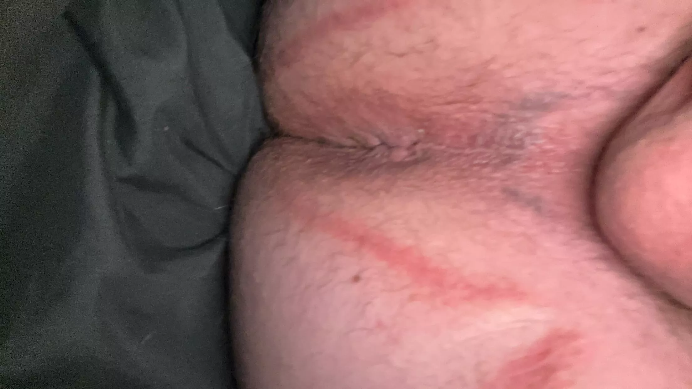 Age [18] pls fill me  posted by Regular-Fee-9861