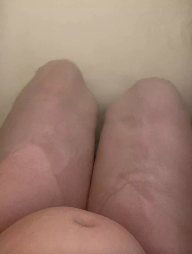 My boyfriend says he likes my stomach. Is it bad?  posted by OhisthatBai