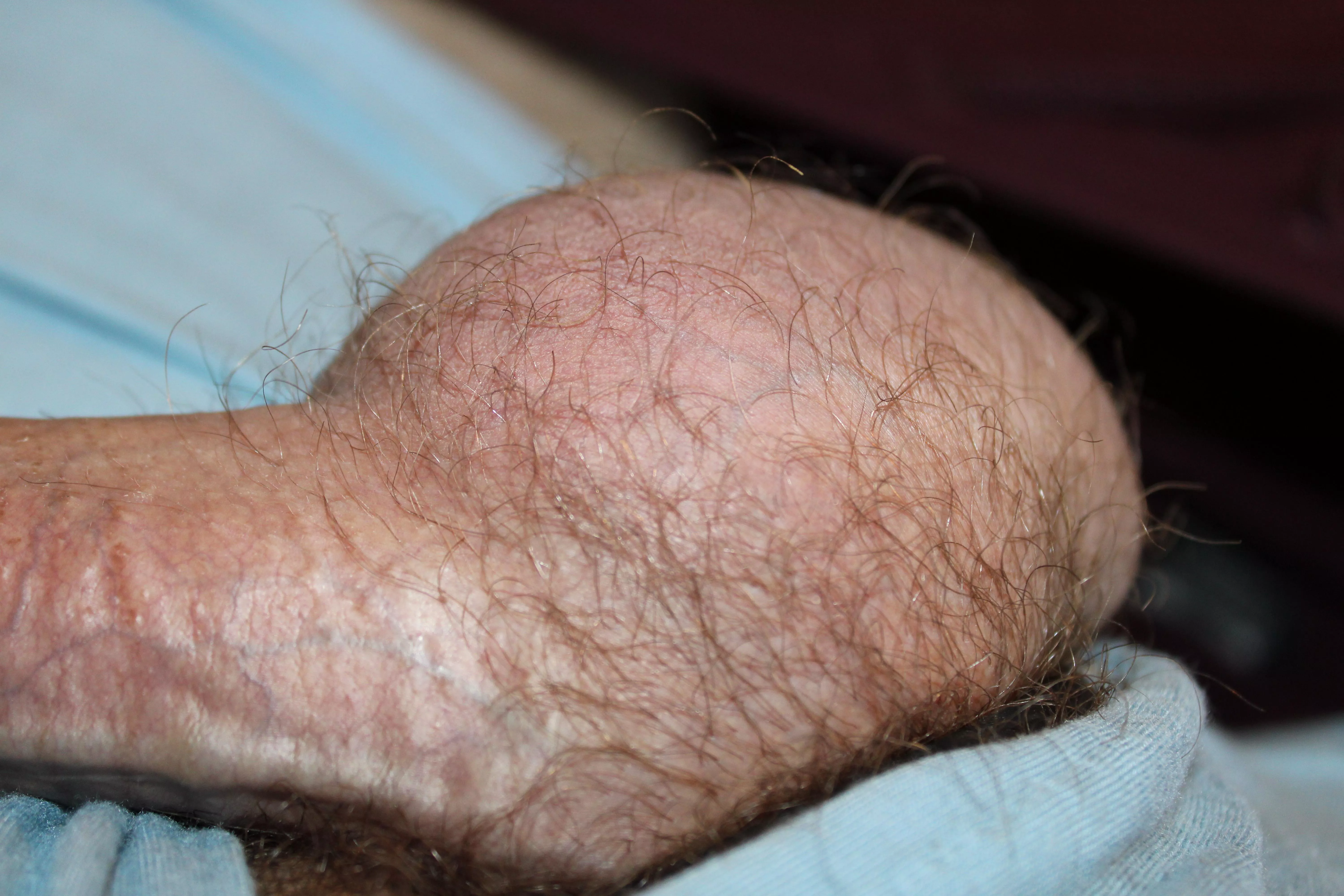 [34] balls posted by greatscotpet