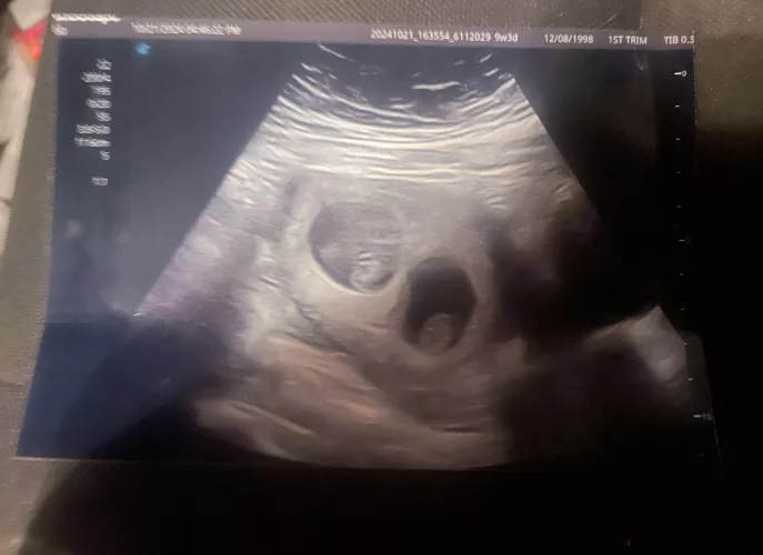 We found out there will be two. by Thick-Interview2647