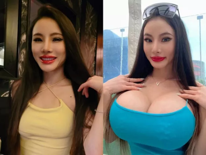 Before and after 1600cc by prezporn