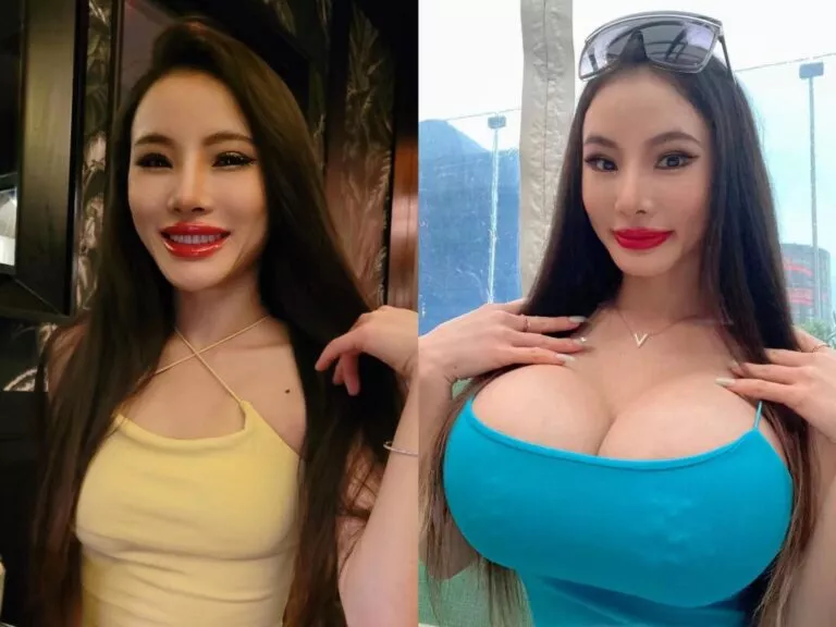 Before and after 1600cc posted by prezporn