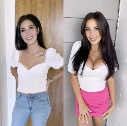 Flat chest to 800cc UHP implants by prezporn