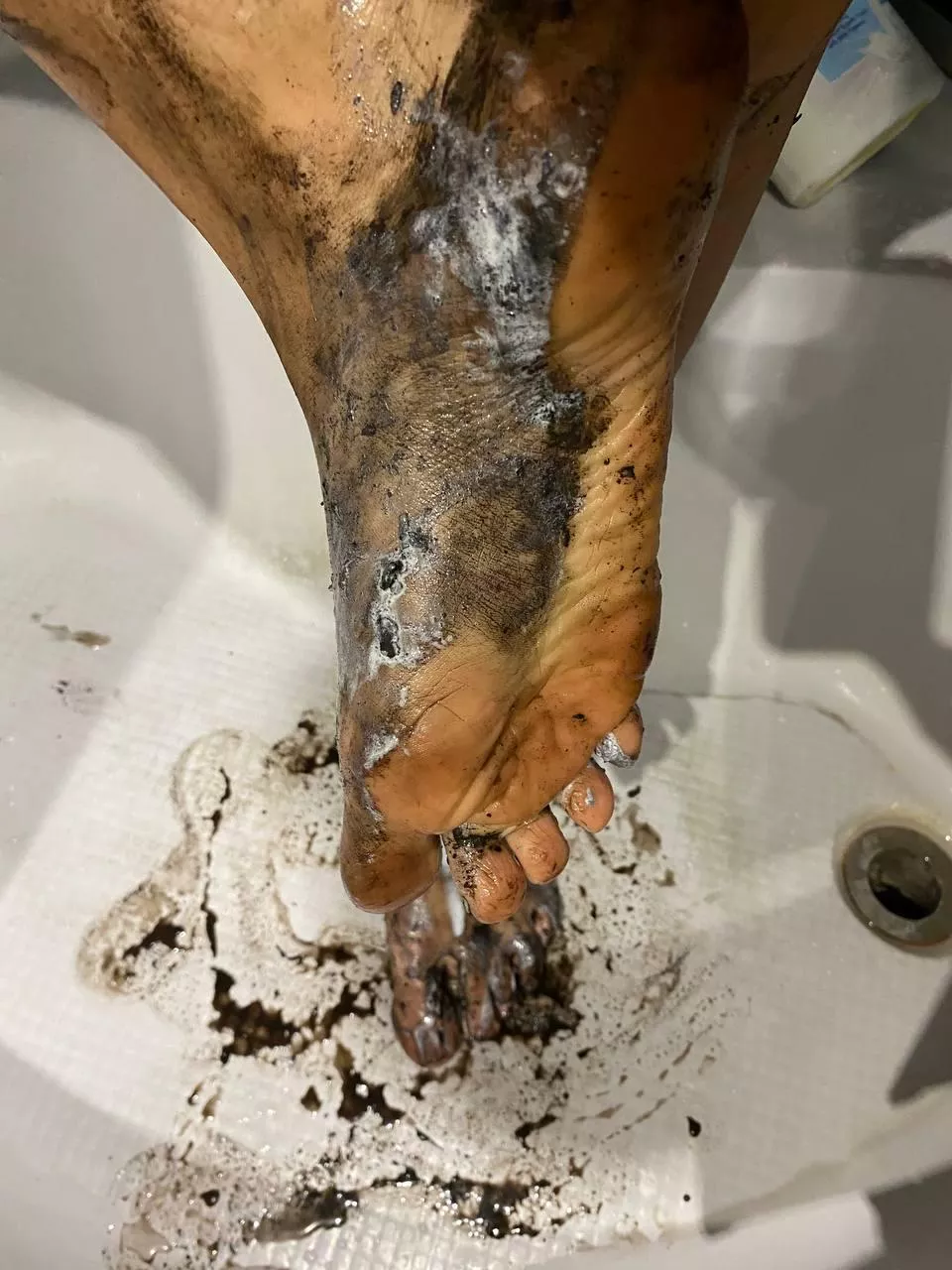Insanely dirty feet that are very difficult to clean posted by NoTrade2614