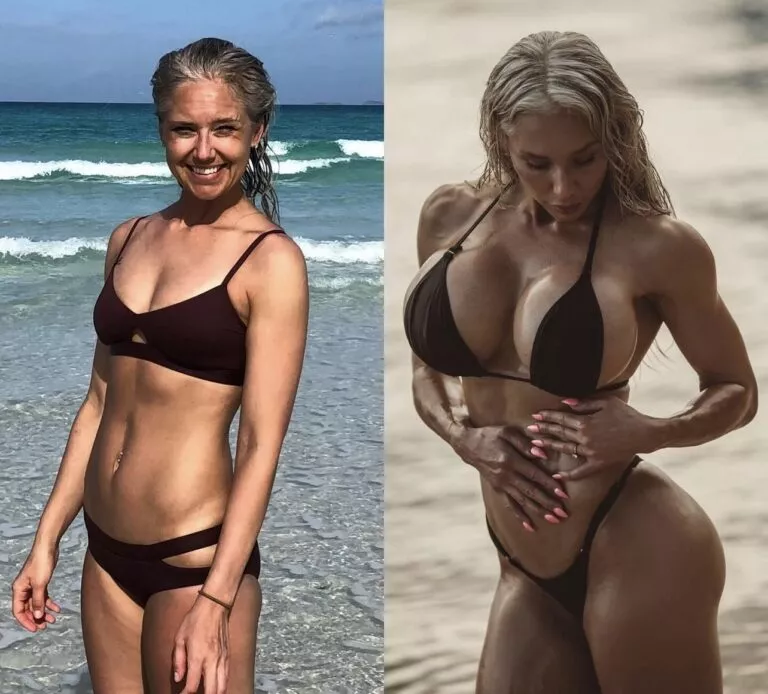 Karen Orlena before implants and at 1600cc posted by prezporn