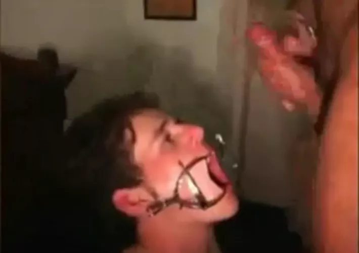 What’s the name of this “device” to spread the mouth open wide? Looking to get it but can’t find it online.  by Far-Law-36