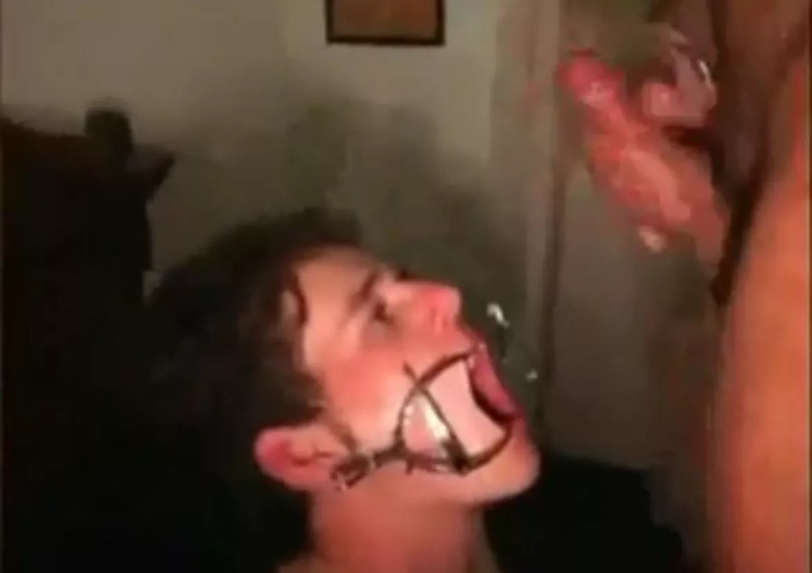 What’s the name of this “device” to spread the mouth open wide? Looking to get it but can’t find it online.  posted by Far-Law-36