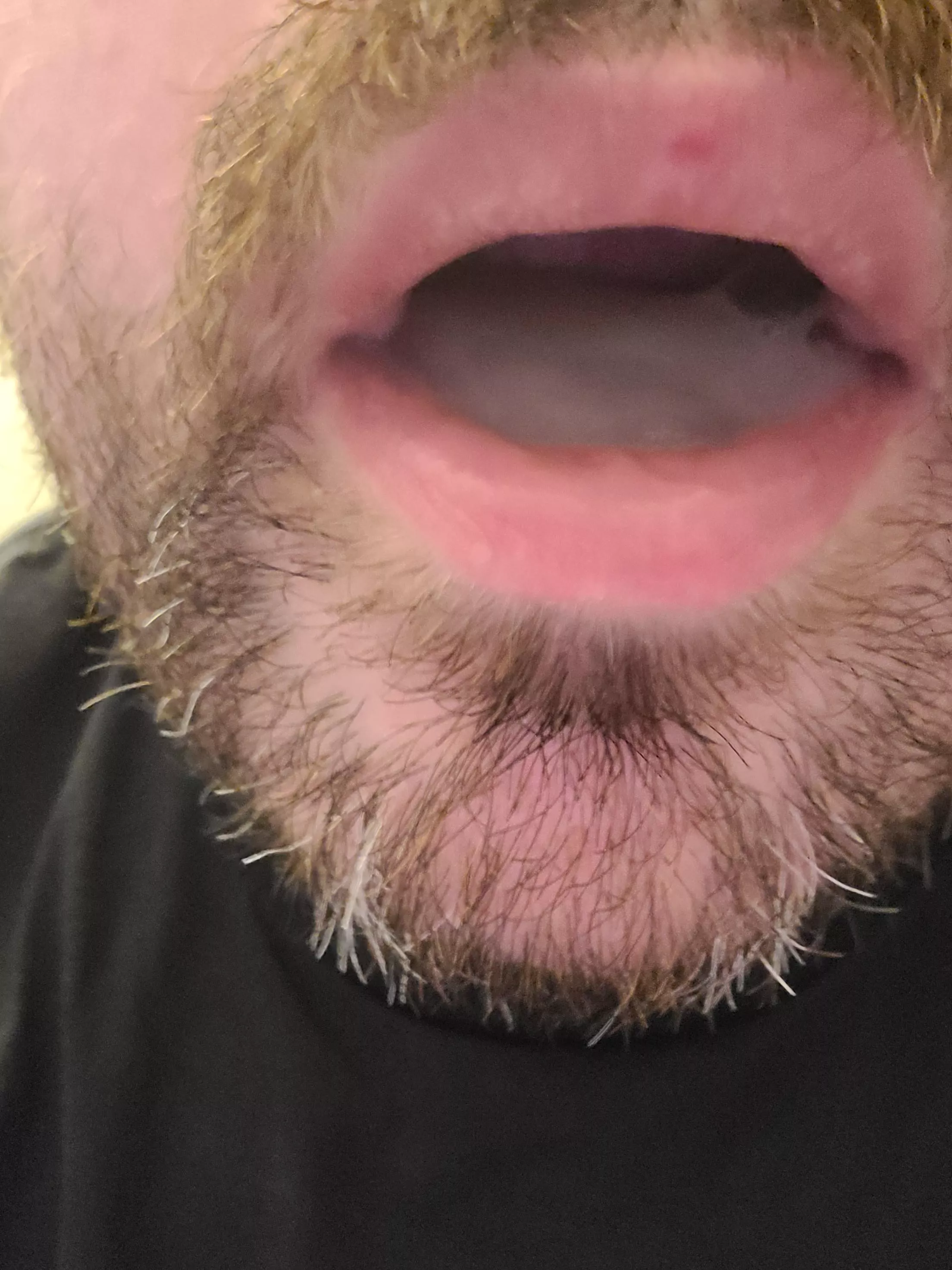 My favorite snack posted by KinkyMDmedic