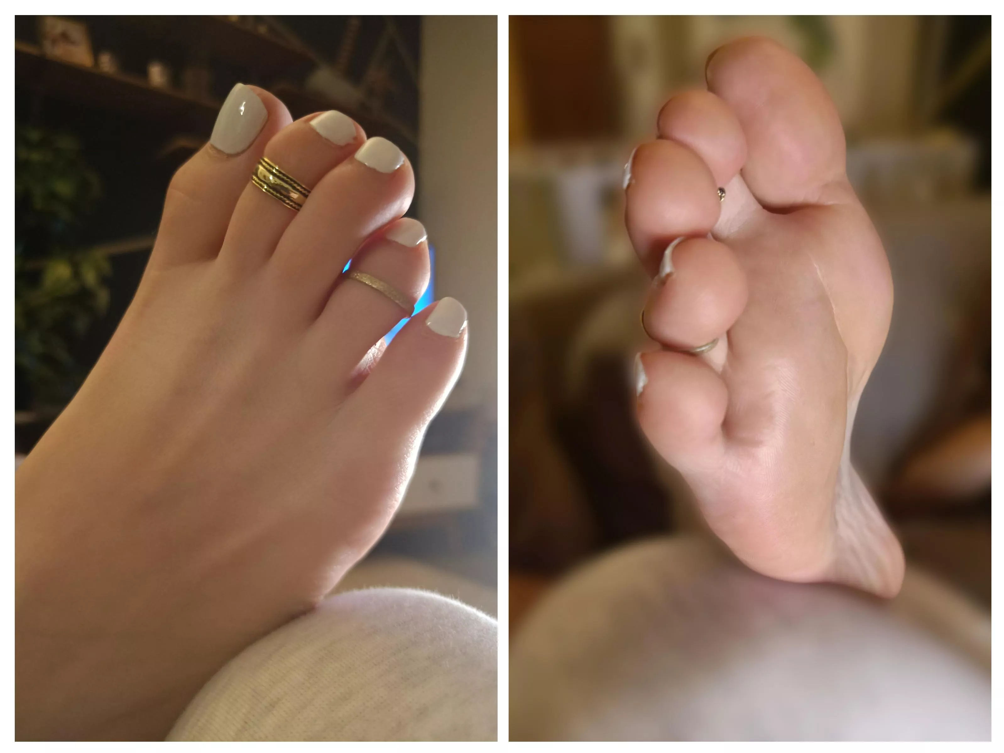 Toerings make it all better!😇🌸 posted by Toe_Tally_Awesome