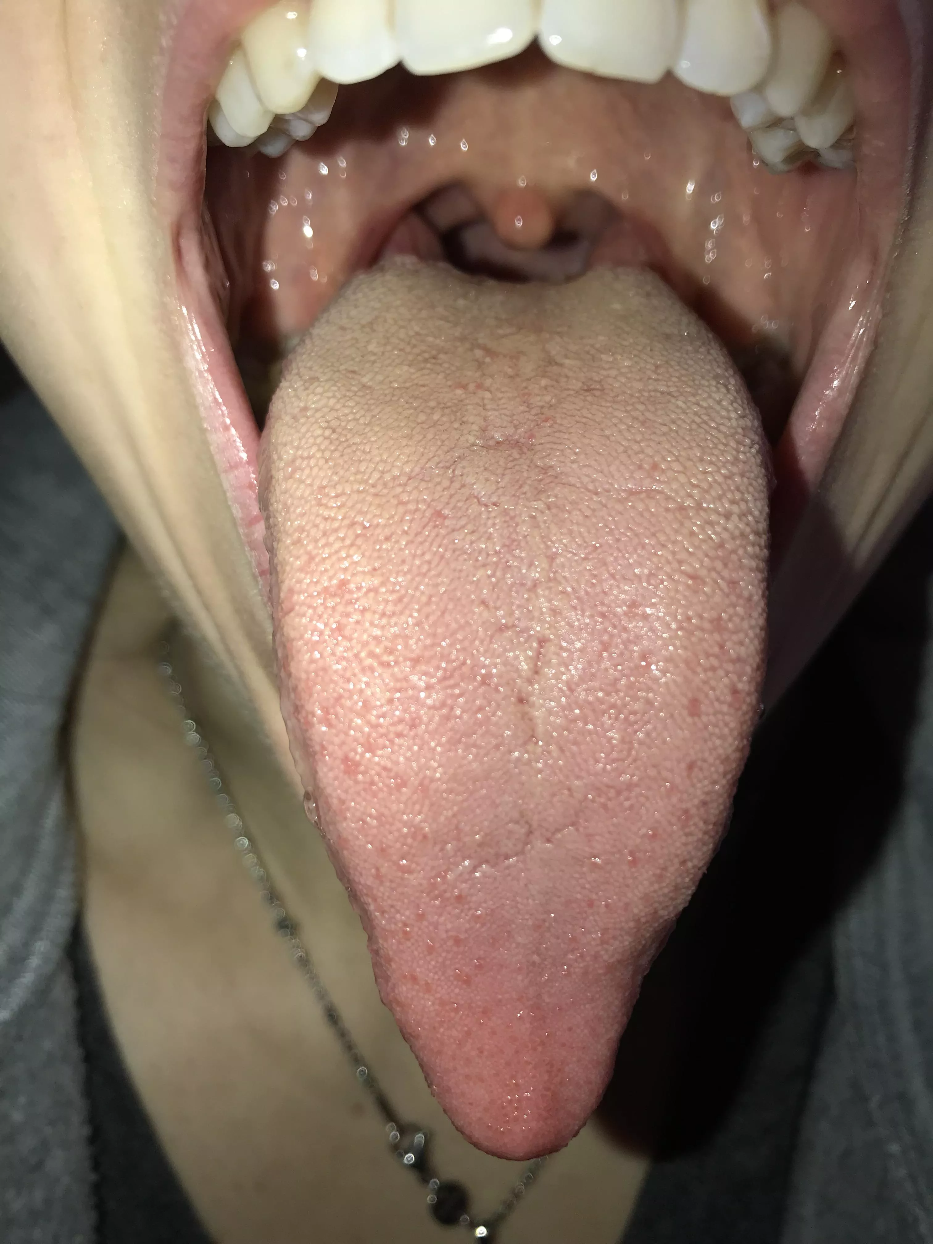 Long tongue time 👅 posted by QueenMoonIsabel