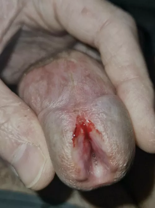 Made a small cut by sxbj88