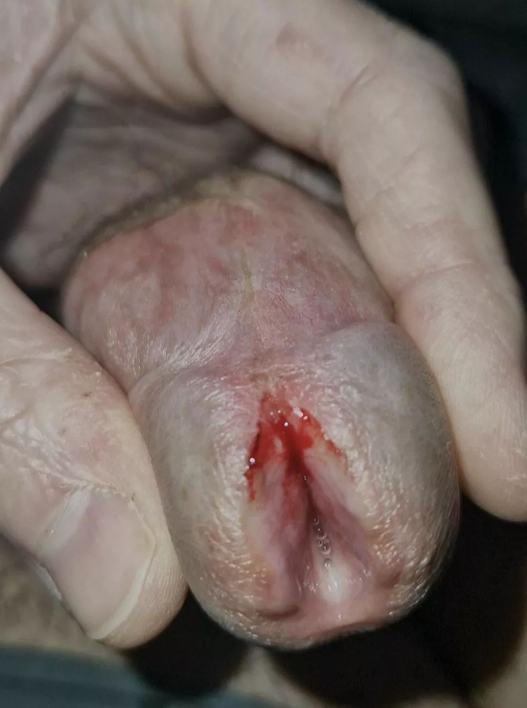 Made a small cut posted by sxbj88