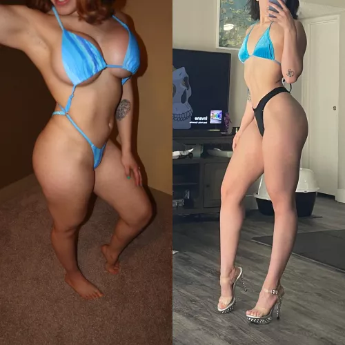 2 months post op 🩵 by RaveKitten14