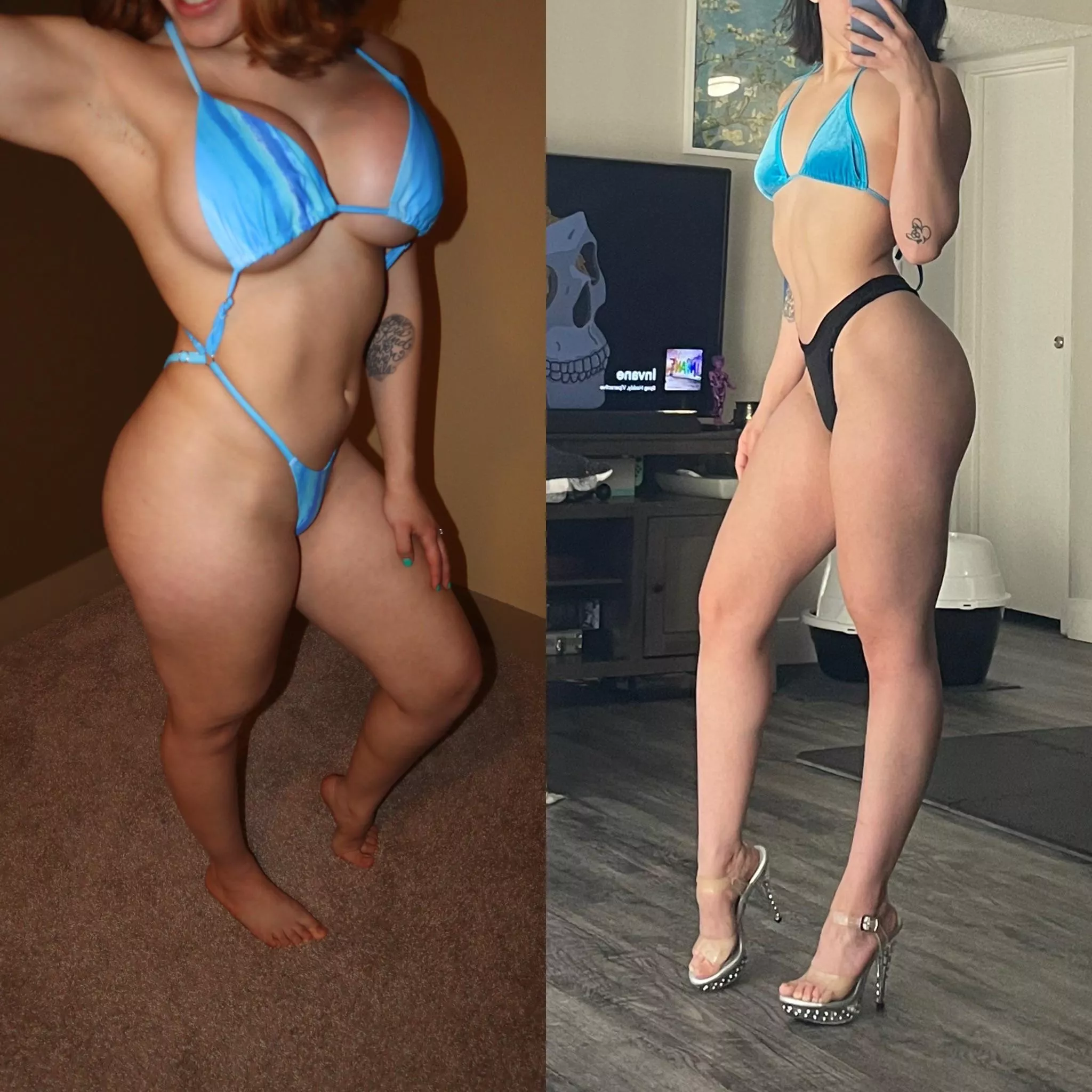 2 months post op 🩵 posted by RaveKitten14