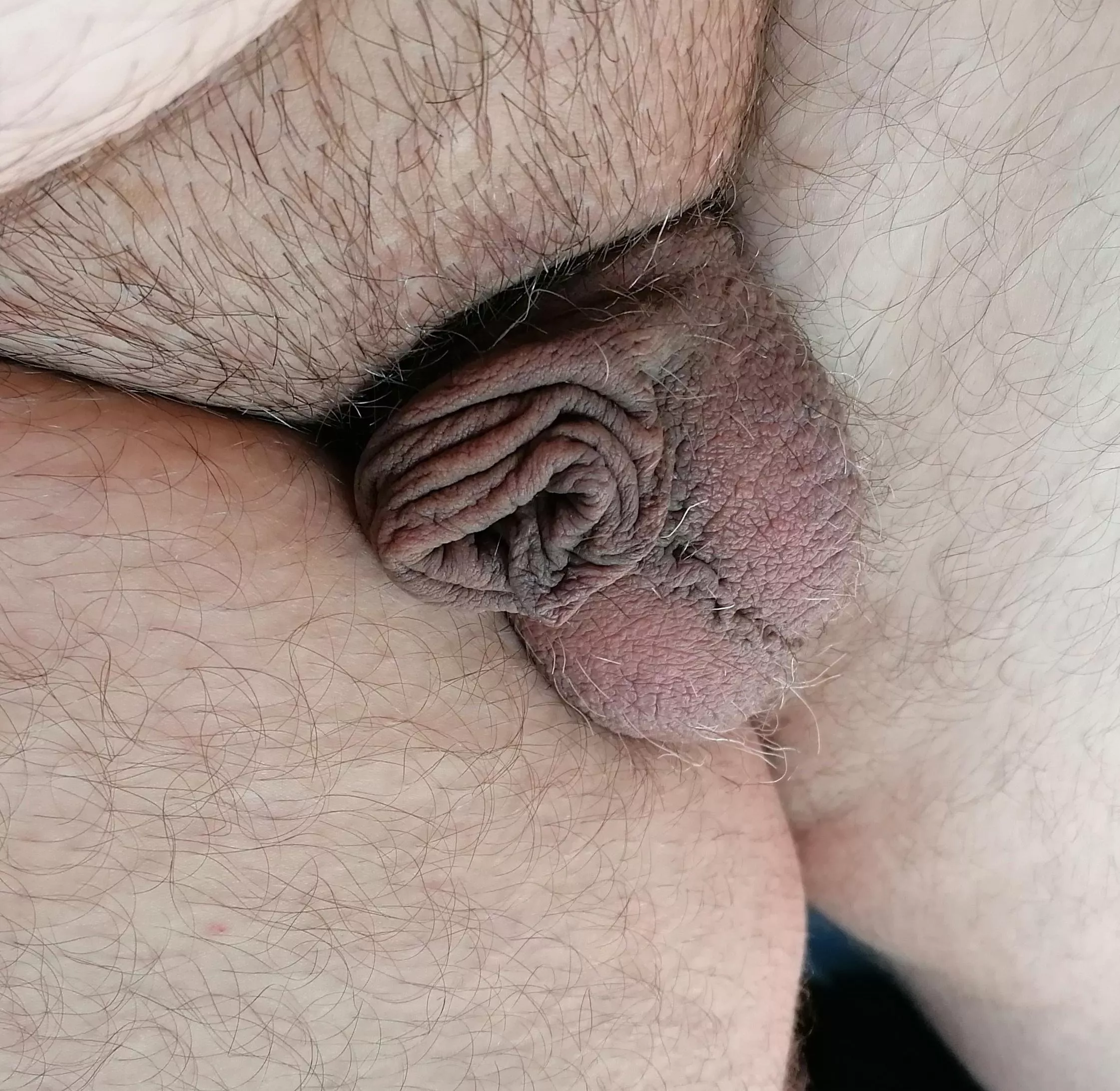 Only foreskin and small balls  posted by Mein-kleiner