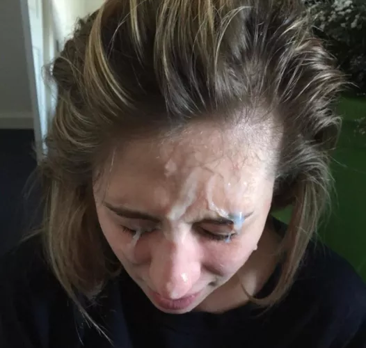 Forehead shot  by Ok_Flan_3022