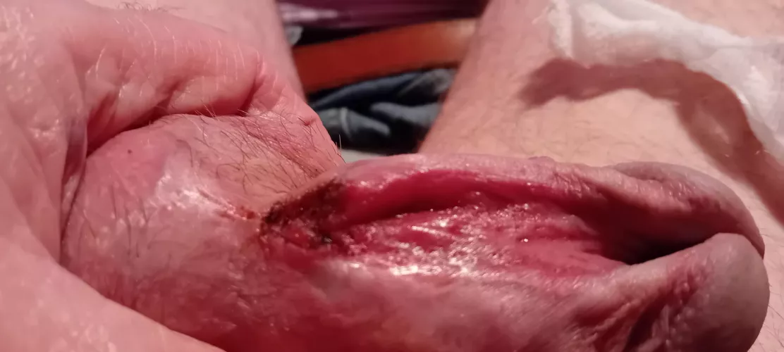 Update  by CompetitiveShame1928