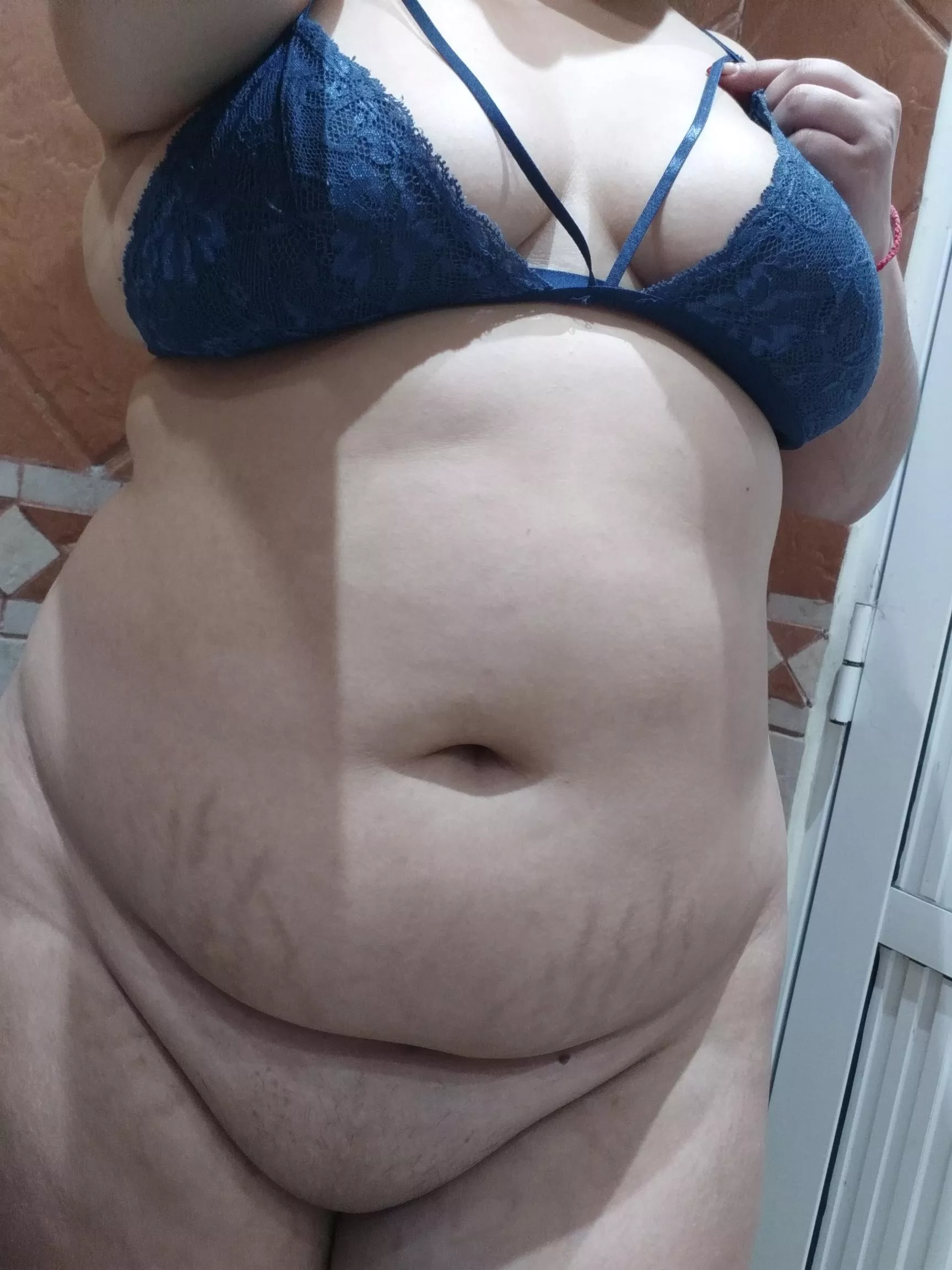 Can you describe my stretch marks? Please  posted by ximenaa_lutz