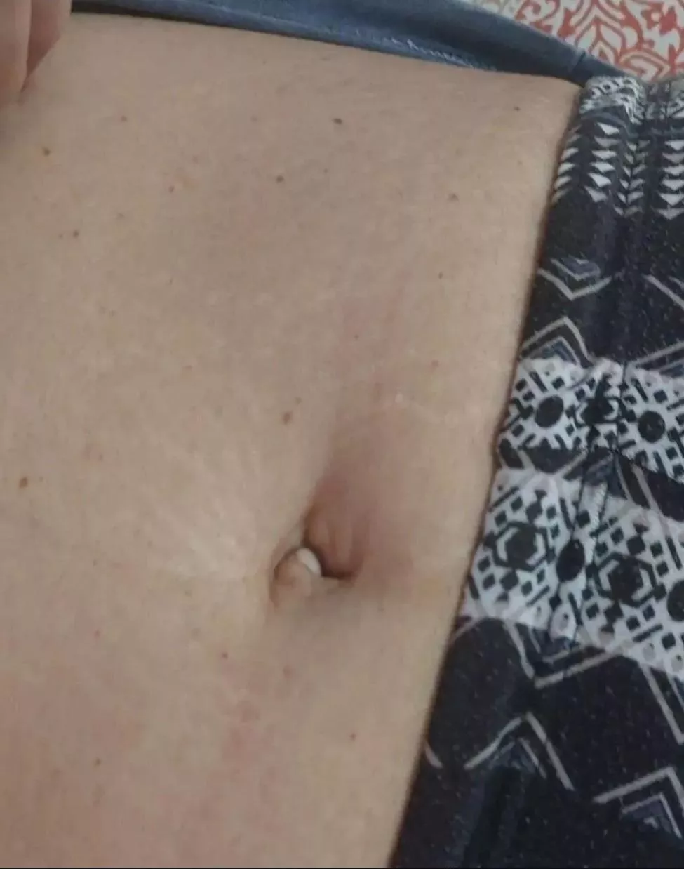 My inbetwinnie navel.(F) posted by Electronic-Bet-4158