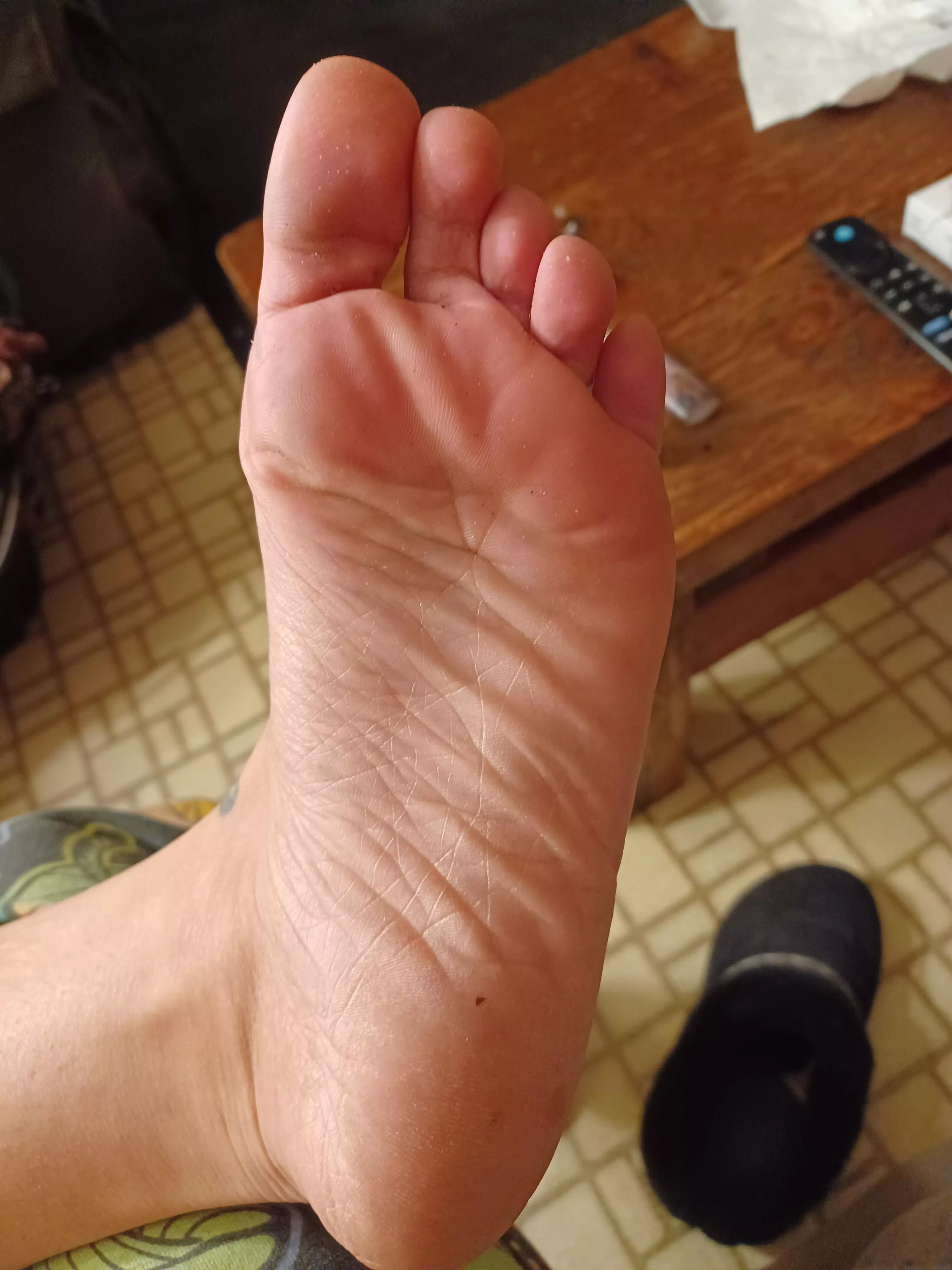 Smelly And Wrinkly Soles  posted by Virtual-Valuable-424