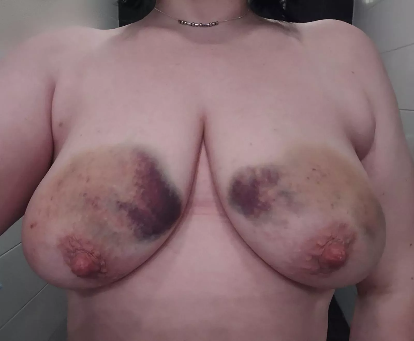 Only slight bruising from my reward spanking posted by Milkyway-Milf